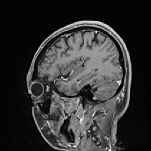 Click on the Serie image to view the images of VILLANUEVA, WILLIAM A.